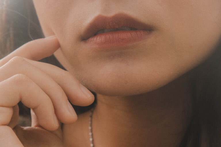 Ästhetikzentrum_Hamm_Blogbeitrag_Lippenaufbau_Nachbehandlung