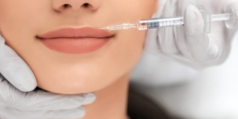 Ästhetikzentrum_Hamm_Blogbeitrag_Lippen_Aufspritzen
