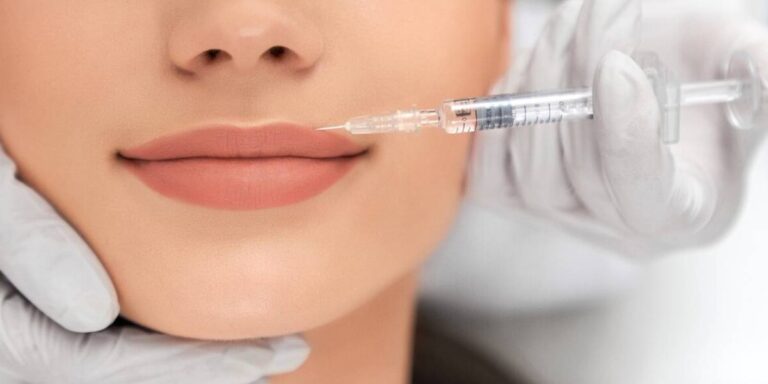 Ästhetikzentrum_Hamm_Blogbeitrag_natuerliche-lippen